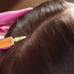 Profile picture of PRP Hair Treatment