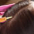 Profile picture of PRP Hair Treatment